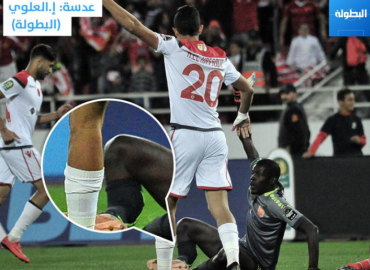 Arrêt sur image: l’horrible fracture de Khadim Ndiaye contre Wydad
